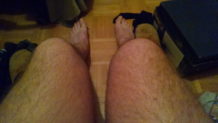 17e-knee.jpg